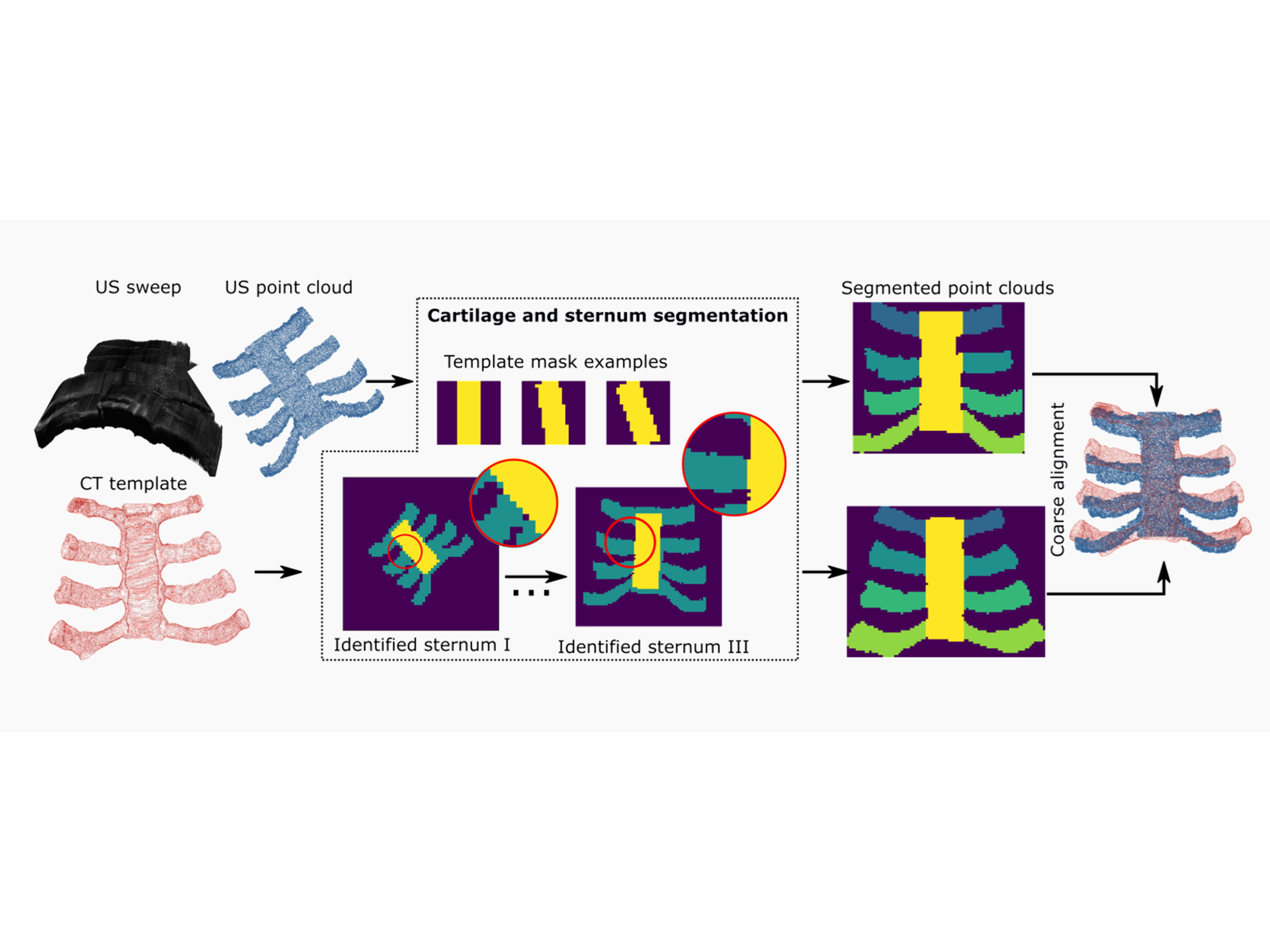 Thoracic cartilage ultrasound-ct registration using dense skeleton graph