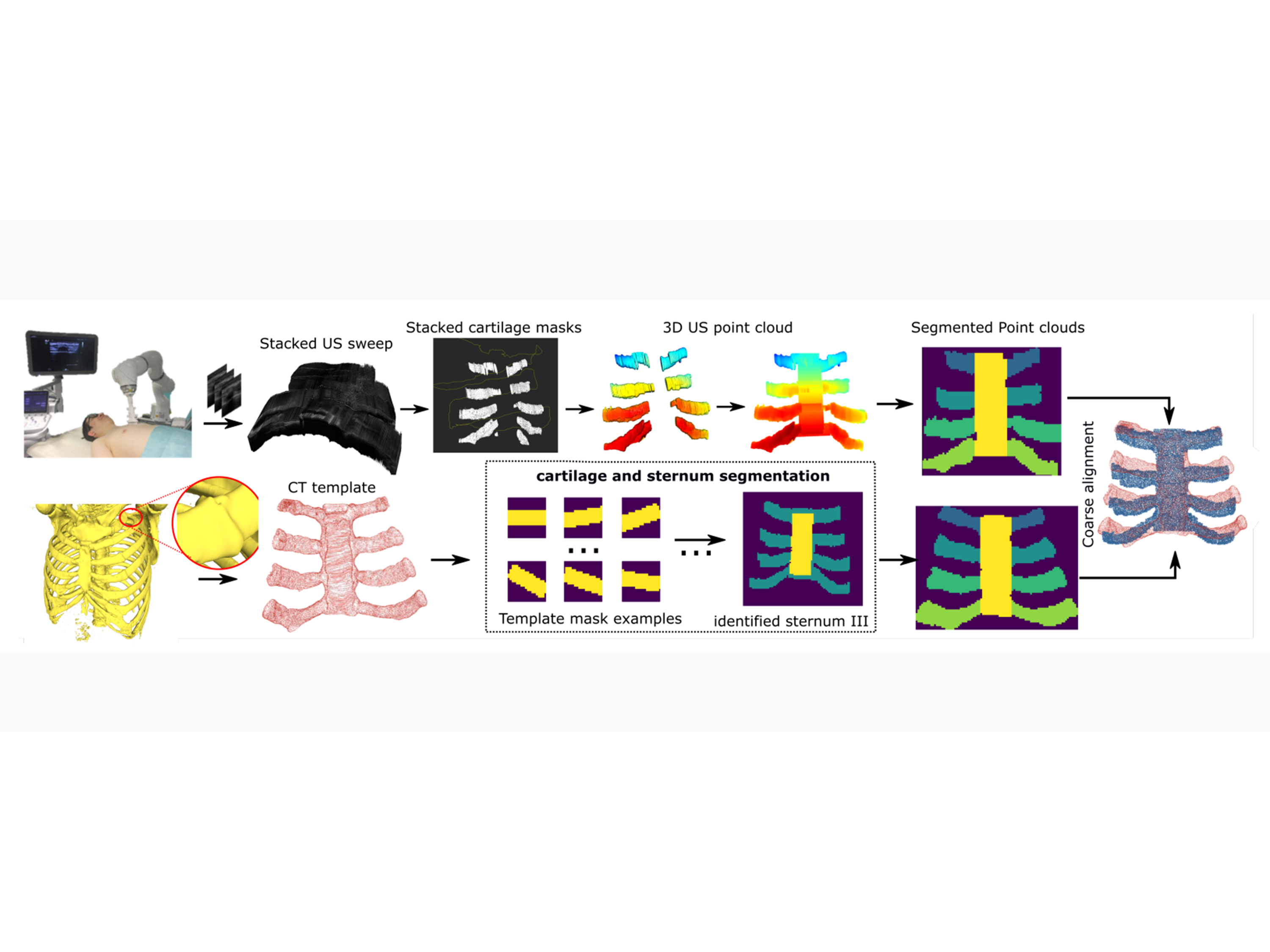 Class-aware cartilage segmentation for autonomous US-CT registration in robotic intercostal ultrasound imaging