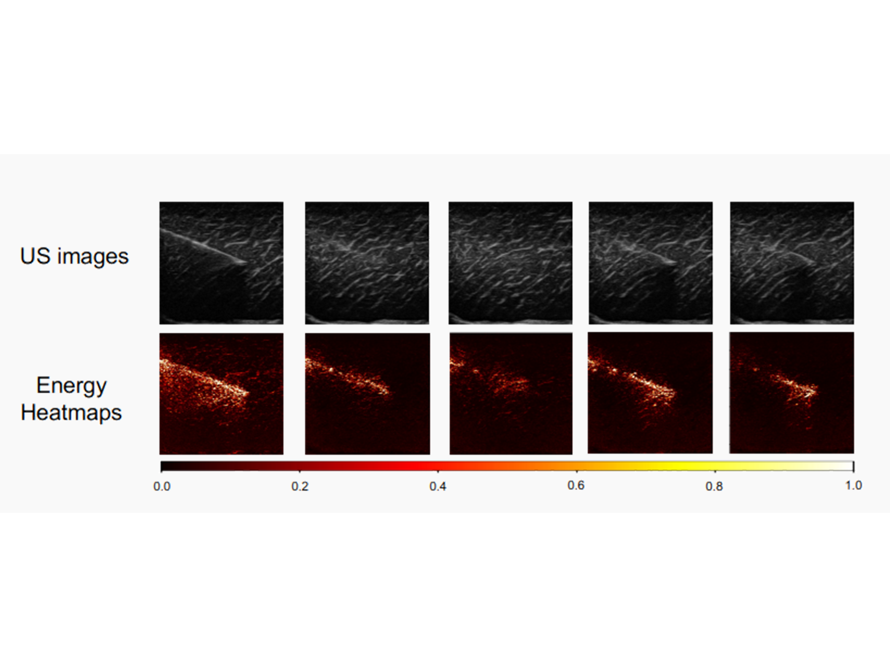 Vibration-Based Energy Metric for Restoring Needle Alignment in Autonomous Robotic Ultrasound (IROS 2025)