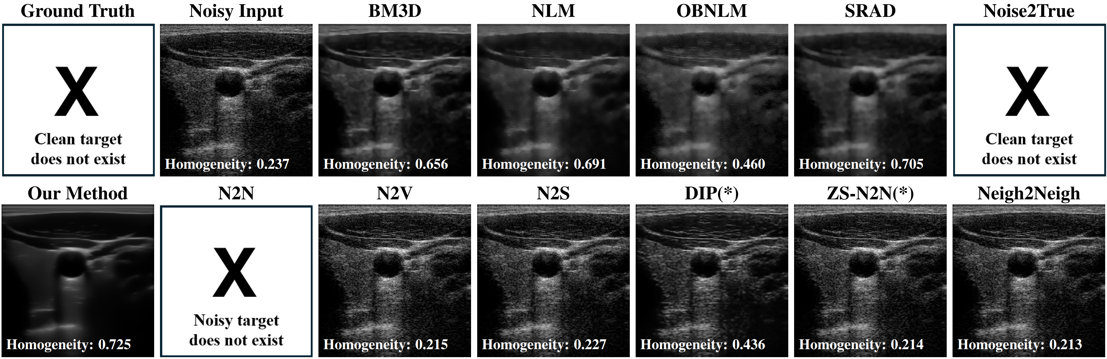 Comparison of despeckling results (In vivo dataset)